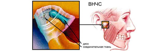 ВНЧС.jpg